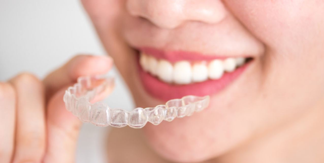 invisalign retainers 